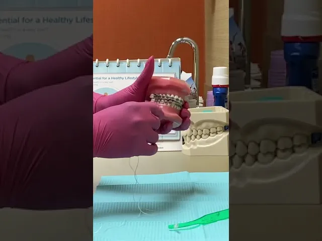 Flossing with Braces Video Thumbnail